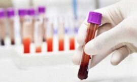 A Blood test can predict your long live?